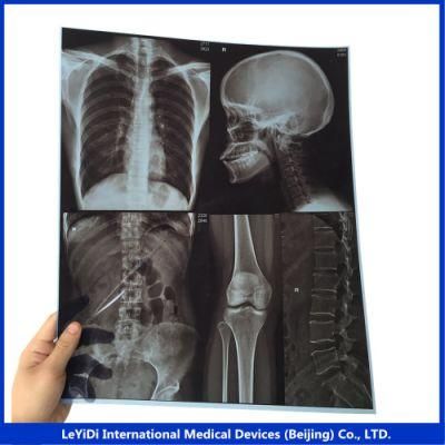 New Laser X-ray Blue Films for Agfa Drystar 5300