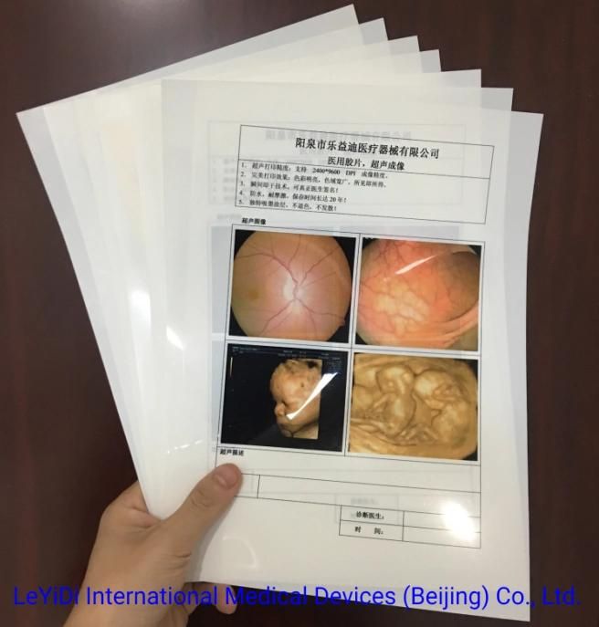 35*43 Cm Laser X-ray Blue Films for Hospital