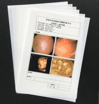 18X24 Cm Medical Laser X-ray Film Blue X-ray Images