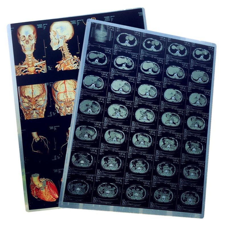 FUJI Printer Medical Laser X Ray Blue Image 14X17 35X43