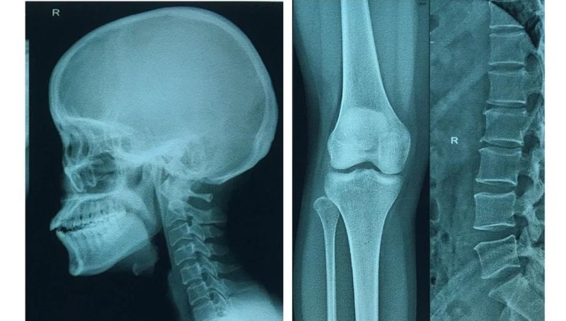 Jumbo Roll Blue Medical FilmX-ray FilmDry Film on Laser Film