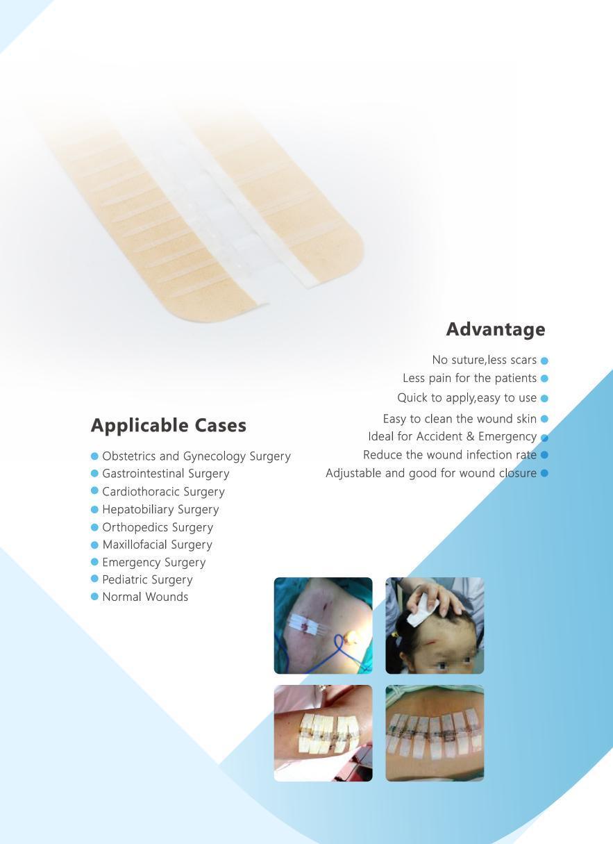 Adhesive Wound Closure Steri Strip Skin Wound Closure