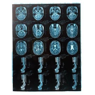 Radiology Dept. and Digitally Store Thermal Sensitive X-ray Image and Dry Film