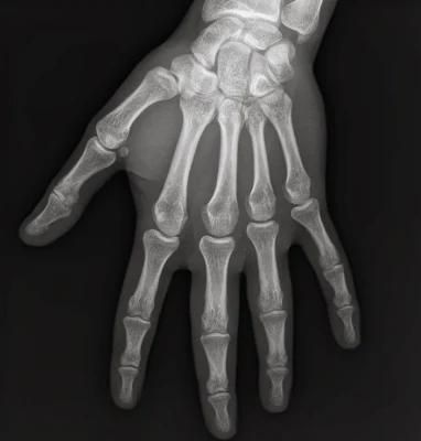 Images of Medical X-ray Film for FUJI Xerox 5005D Printer