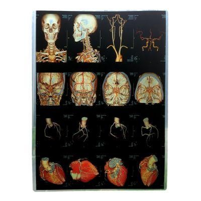 Inkjet Printing Film for MRI Cr CT Dr X-ray Image Printing
