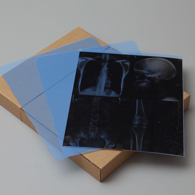 8*10 Inch Medical Dry X-ray Film for Inkjet Cannon Printers