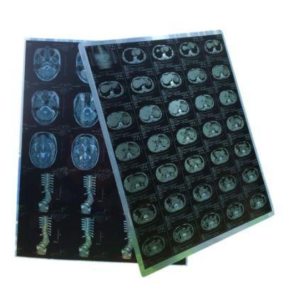 Blue Color 10*12 and 13*17 Inch X Ray Image Thermal Medical Dry Film