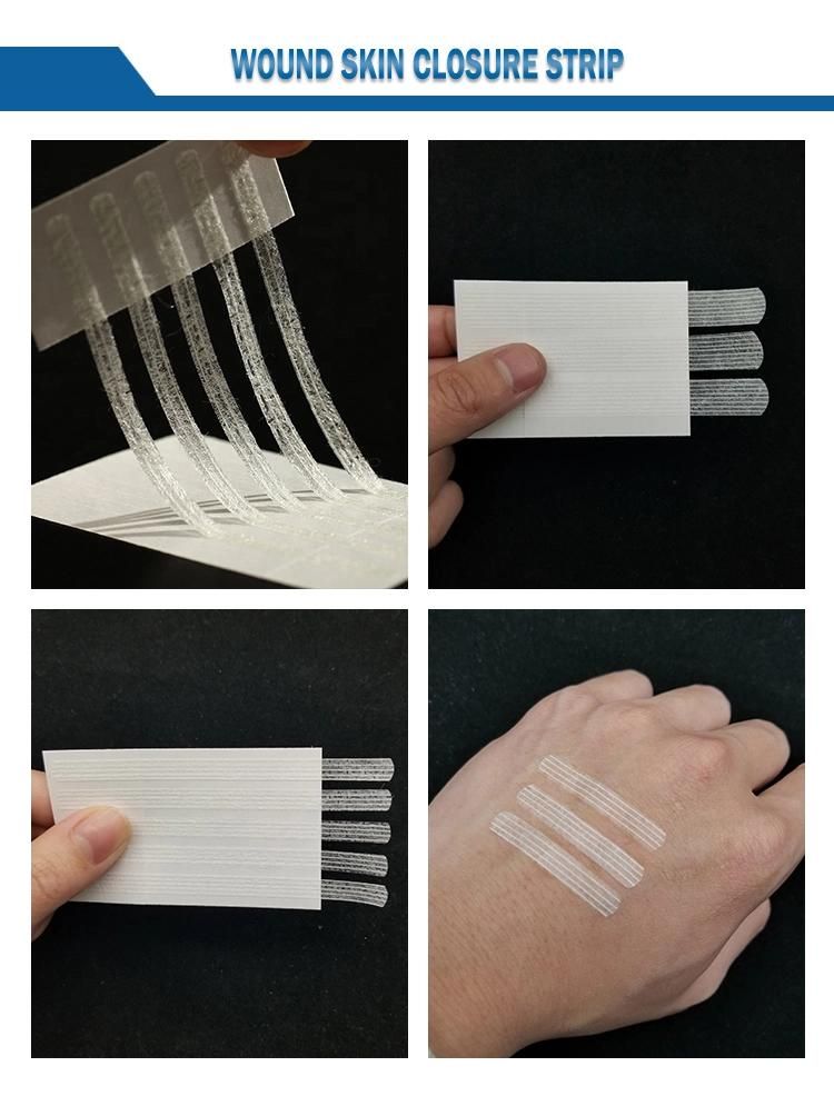 New Arrival Disposable Wound Skin Closure Strip for Wound Skin Close Care