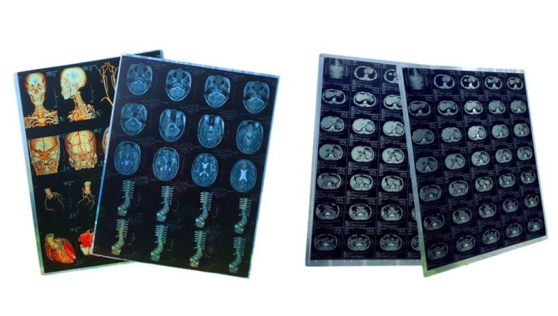 Doctors Physician Medical X-ray Image/Film for Hospital MRI & CT