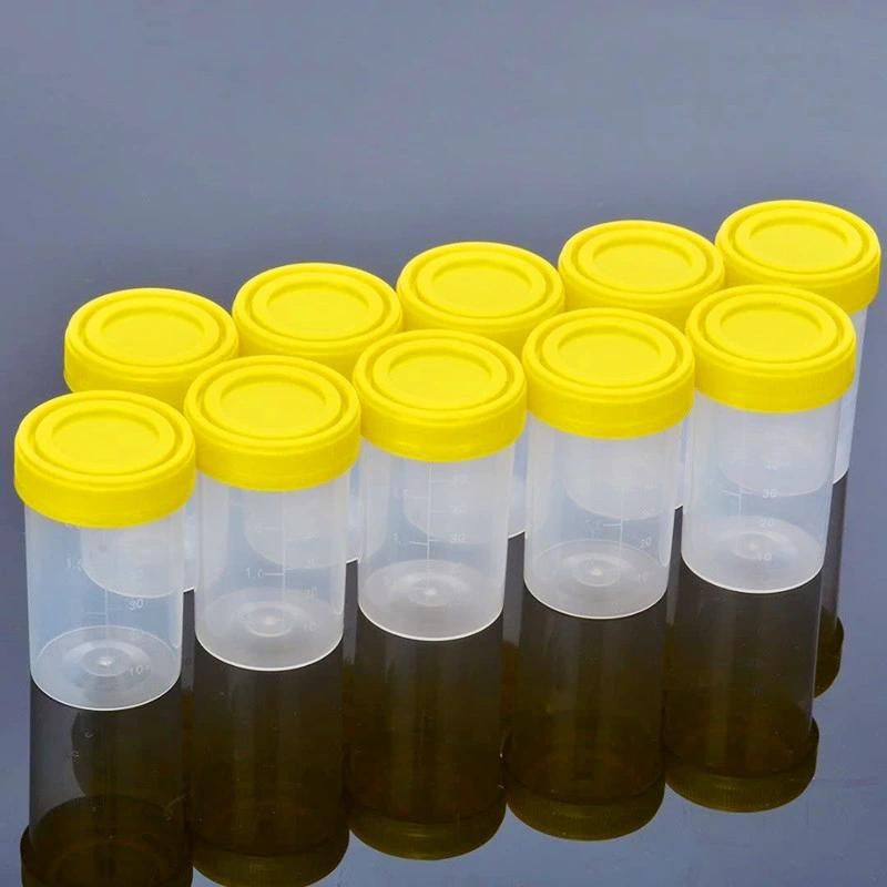 10ml/30ml/60ml/90ml/120ml Medical Sterile Specimen Urine Cup Collection Container