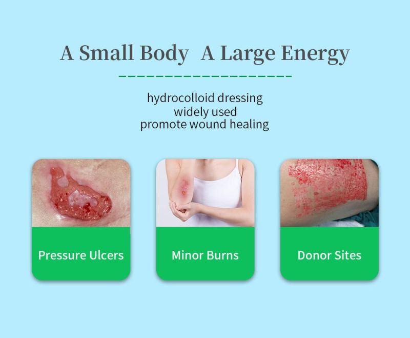 Material Good Absorption Hydrocolloid Dressing for Foot Blister Minor Burn as Wholesale Wound Medical Care Wholesale Price