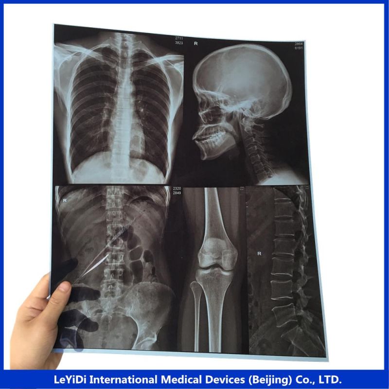 Drystar Dry Medical Film 35X43cm 14X17 in. Made in China
