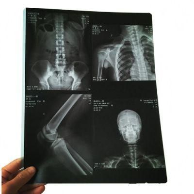 Medical Pet Radiographic Inkjet Blue Film for Epson/Canon
