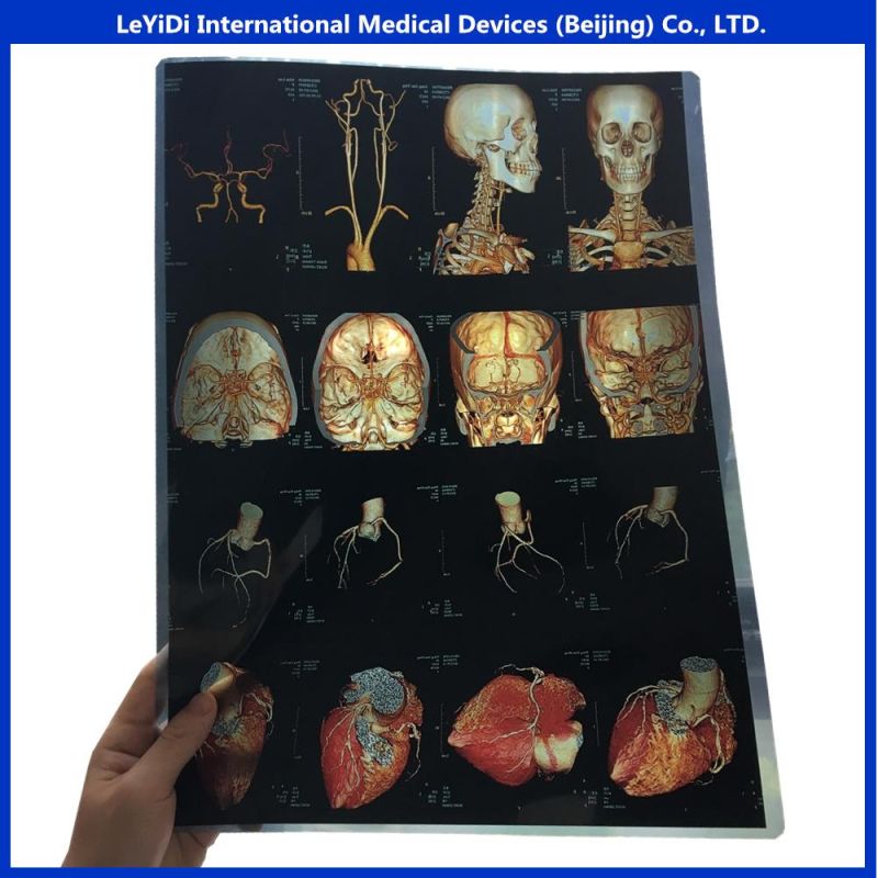 Hospital Medical Dry Imaging Film 8X10 in 20X25 Cm
