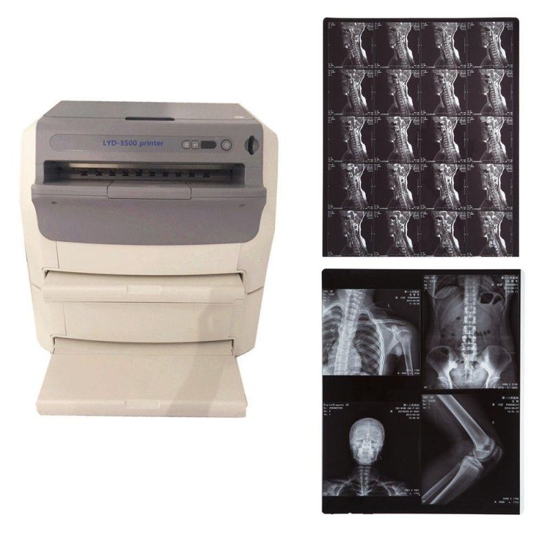 Blue Inkjet Mammogram X-ray Films