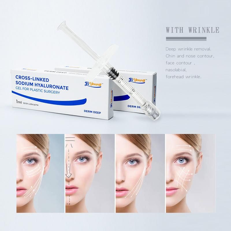 Hyaluronic Acid Dermal Lip Filler 2ml for Hyaluron Pen Use