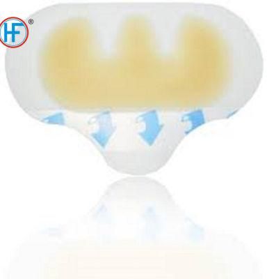 Mdr CE Approved First Aid Adhesive Plaster OEM Relief Plaster for Wound
