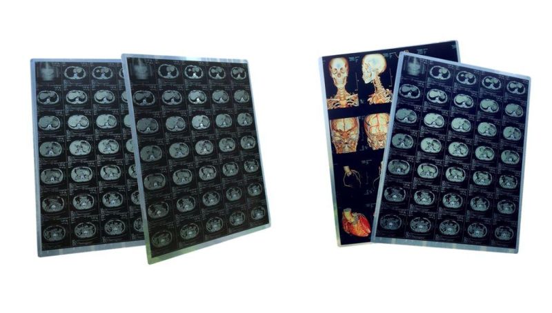 Medical X-ray Film Blue Sensitive, X Ray Film Blue 13*14