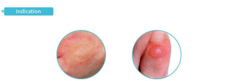 Waterproof Good Absorption Foam Wound Dressing Silicone