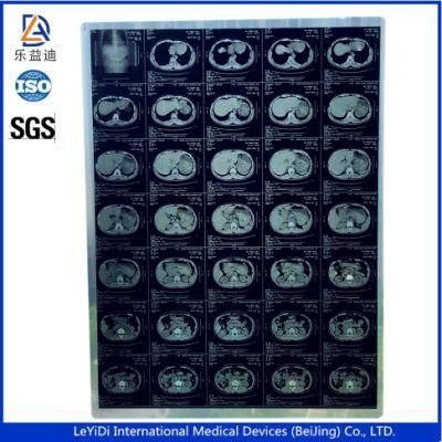 Dry Imaging Printer Films X-ray Film 11*14 Inch