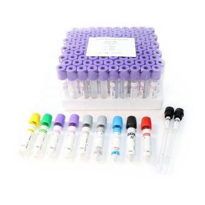 Blood Sample Specimen Collection Tubes Sodium Citrate Anticoagulant Vacuum Tube