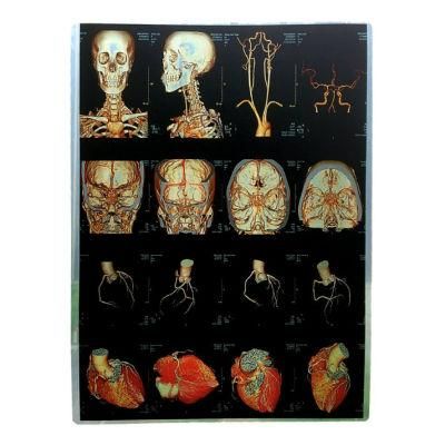 Medical X-ray Film-Inkjet-Single 14*17 Inch High-Resolution Medical Color Inkjet Printing Film