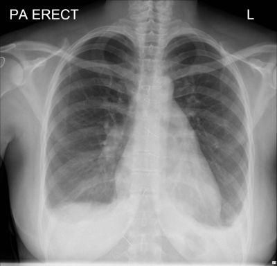 FUJI Printer Medical Laser X Ray Blue Image 14X17 35X43