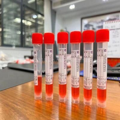 Professional Manufacture of Specimen Collection Swab Single-Use Virus Sampling Tube Disposable Virus Sample Tube