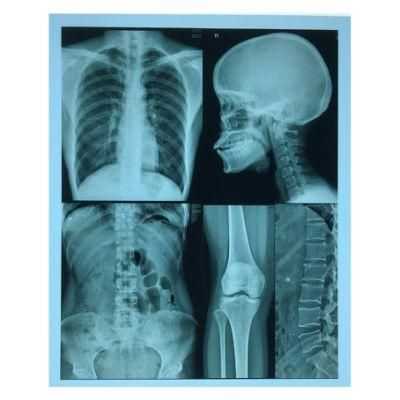 Inkjet Blue Printing Paper Medical Films 10X12 Inch