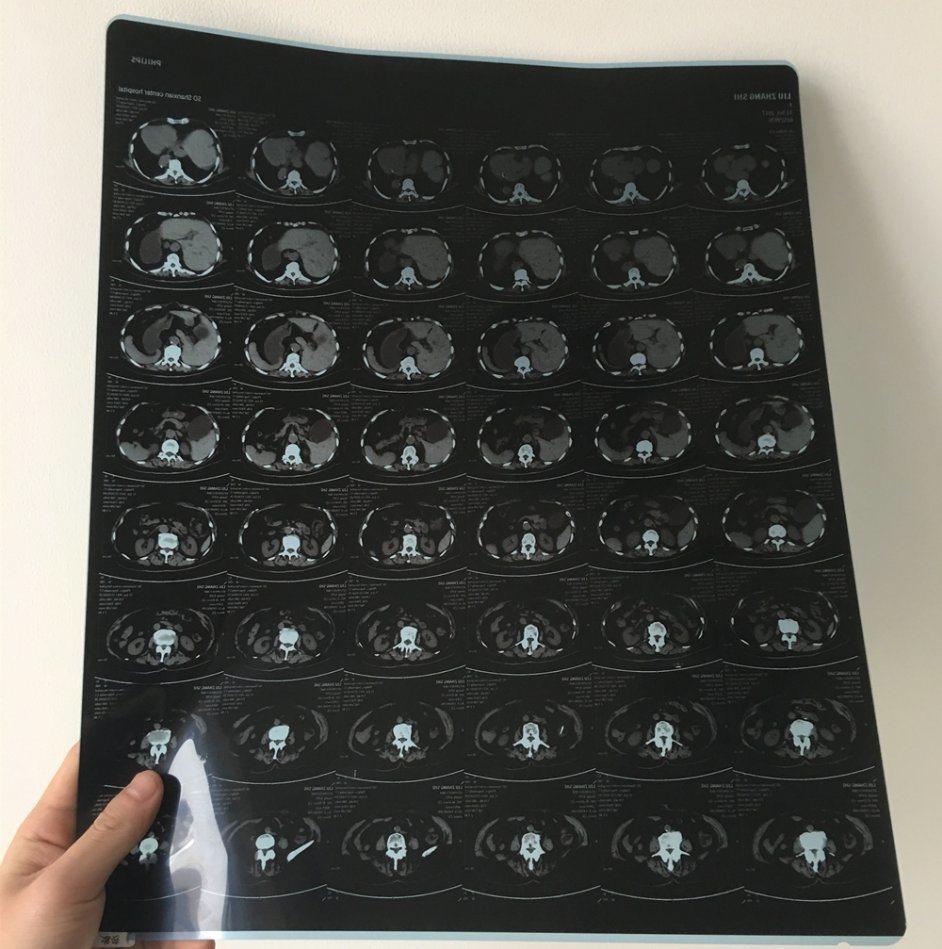 8*10 and 10*14 Inch Medical Cheap Di-Hl Dental Inkjet Medical Dental Film