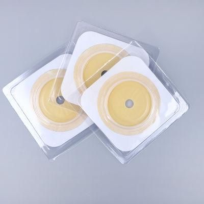 Factory Stoma Medical Urostomy Colostomy Urinary Ostomy Chassis