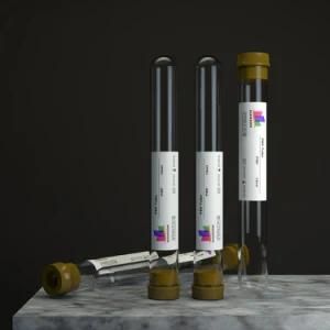 Platelet Rich Fibrin Prf Manson Centrifuge Platelet Rich Plasma Fibrin Prf Tube