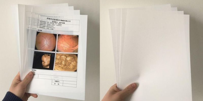 Laser Printer Film, Laser X-ray Film for Agfa Printer