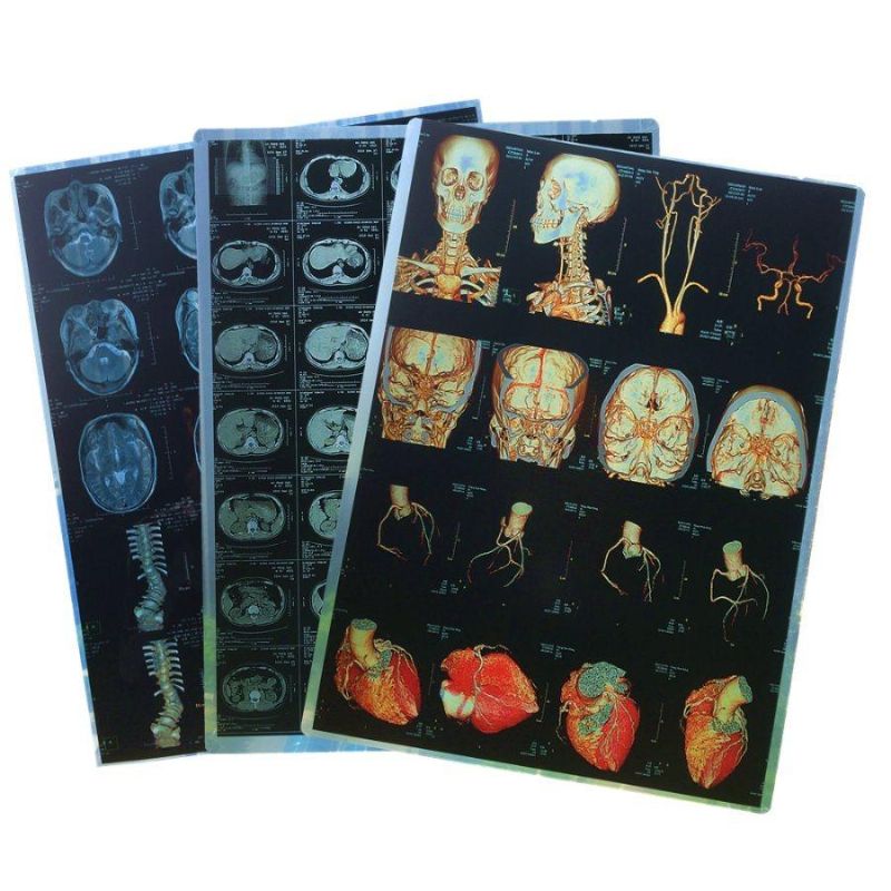 Inkjet Printing Film for MRI Cr CT Dr X-ray Image Printing