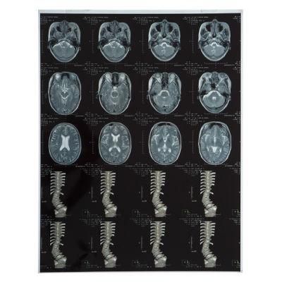 Medical Laser X-ray Film Blue &amp; White Base