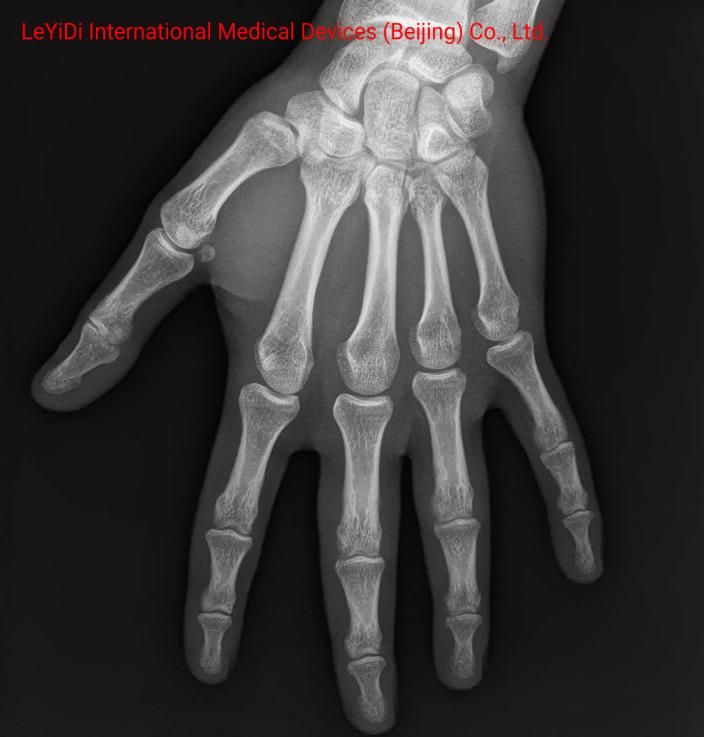 X-ray Film 14X17" Medical Equipments Cr Digital