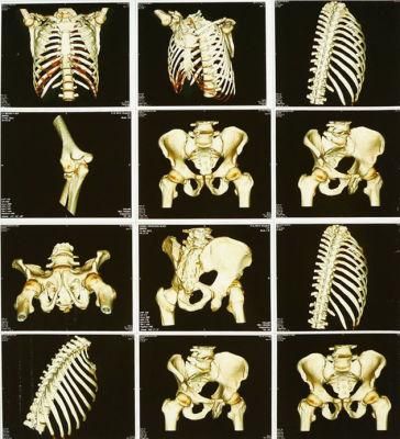 13*17 Inch and A3 Printing Medical X-ray Film Inkjet Film