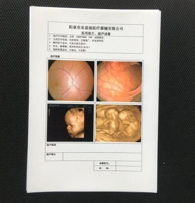 Good Quality Medical Disposables Dry Inkjet Film Medical Paper for Hospital