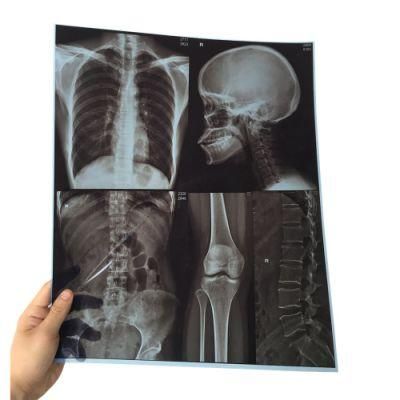 Medical Dry Laser Imager for FUJI and Agfa Printer