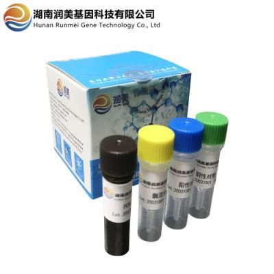 Virus Nucleic Acid Detection Kit Fluorescent Rt-PCR Method
