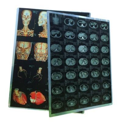 1417 Thermal Blue Color Sensitive Dry X Ray Film