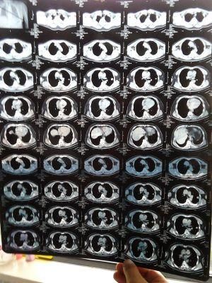 Thermal Printing Film Blue Film