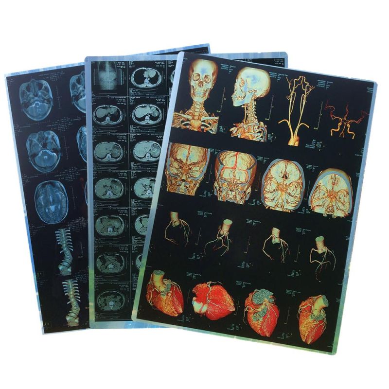 Inkjet Blue Printing Paper Medical Films 10X12 Inch