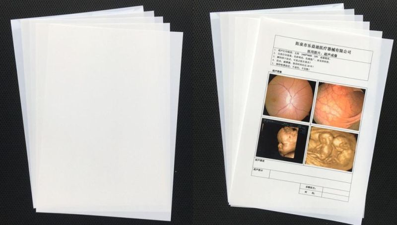 10X12 Inch Pet X-ray Laser Medical Films