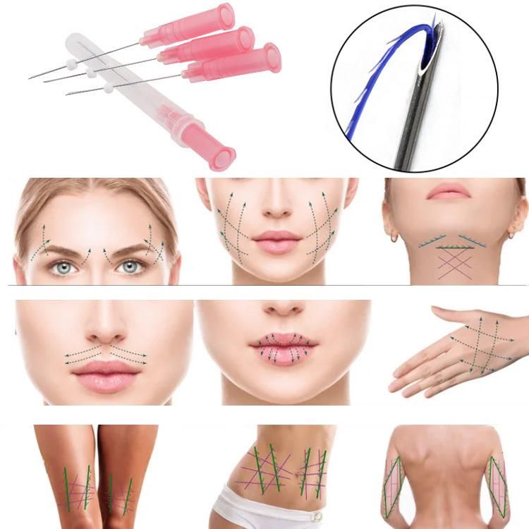 Heremefill Pdo Lift Face to Remove Wrinkles Fishbone Line