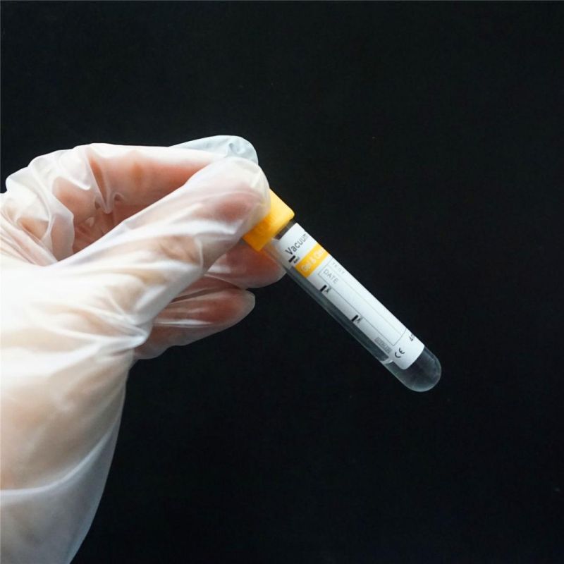 Disposable Medical Blood Collection Tube with Ce