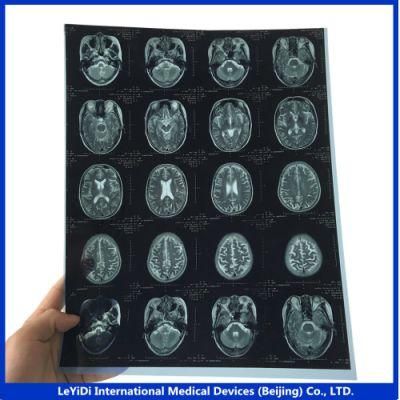 Blue Base Medical Dry Imaging Film
