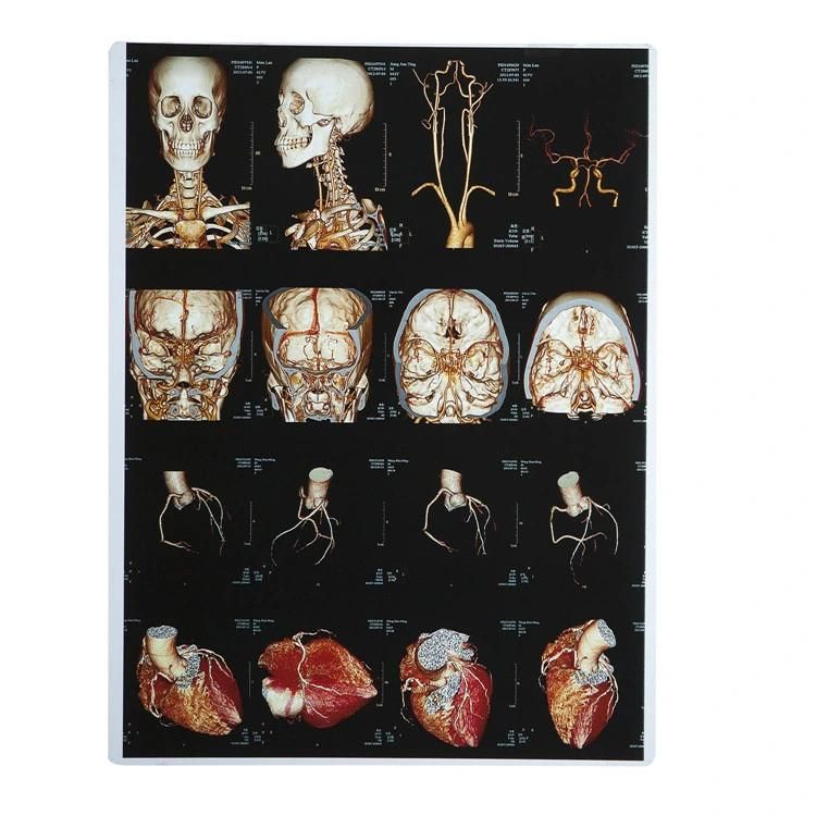 Jumbo Roll Blue Medical FilmX-ray FilmDry Film on Laser Film