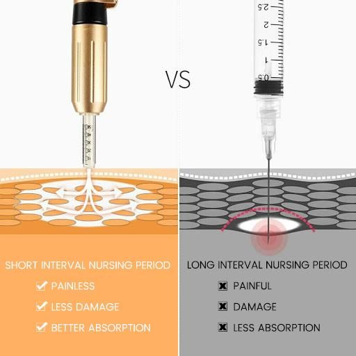 Anti Wrinkles Injectable Dermal Filler Hyaluronic Acid Filler 2ml for Beauty