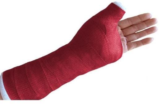 Disposable Medical Fiberglass Casting Tape Orthopedic Casting Tape with CE/FDA Certificate